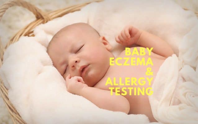 baby eczema and allergy testing