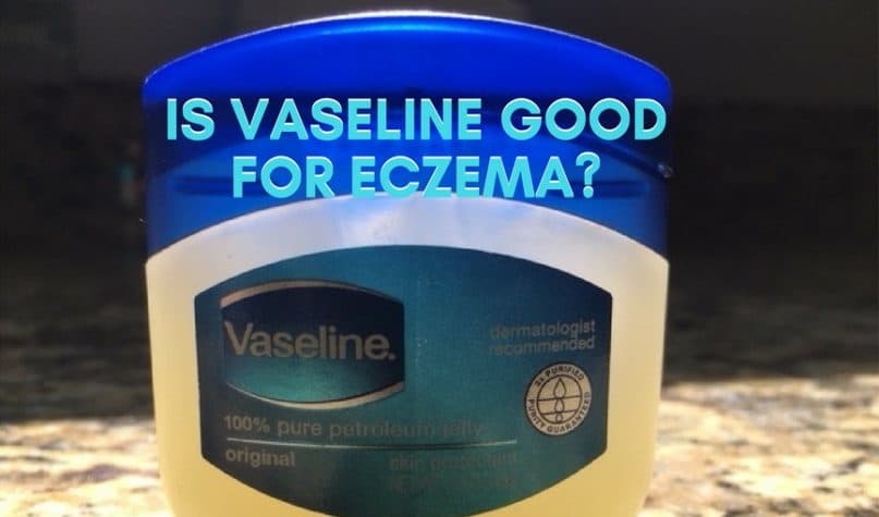 Is Vaseline good for eczema