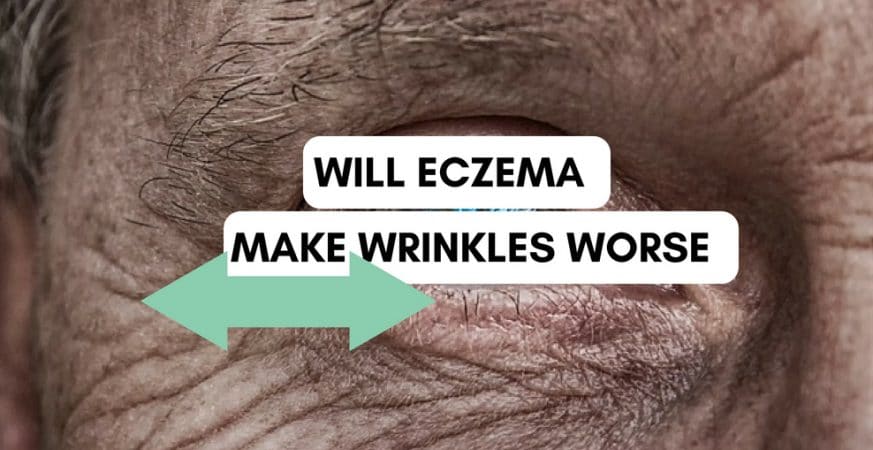 Will eczema make wrinkles worse around the eyes